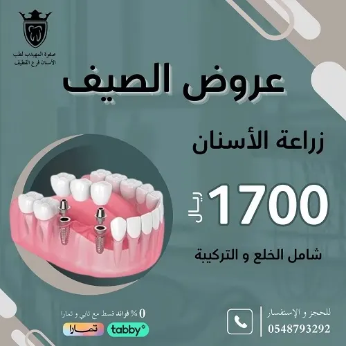 فرع القطيف.. صفوة المهيدب.. زراعة الأسنان بـ 1700ر.س