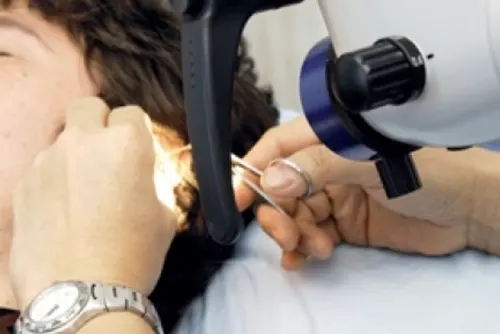 زراعة 288 عملية قوقعة في “التجمعات الصحية” خلال 6 أشهر
