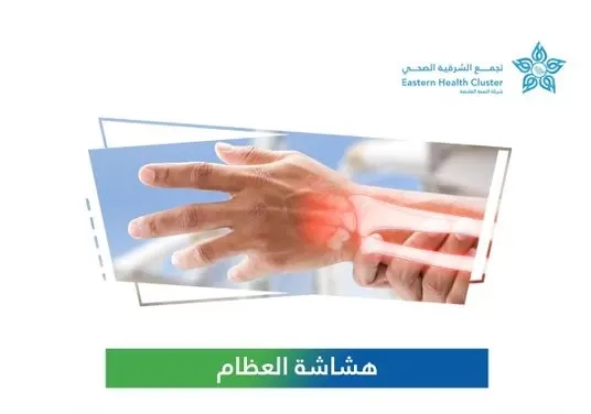 تجمع الشرقية: هشاشة العظام مشكلة شائعة تتطور ببطء