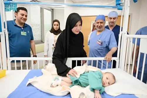 إنفاذًا لتوجيهات القيادة.. بدء فصل التوأم الطفيلي المصري محمد جمعة
