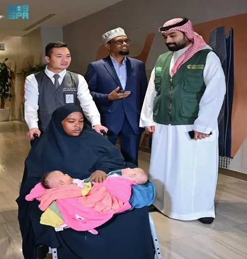 وصول التوأم الصومالي الملتصق “رحمة ورملا” إلى الرياض