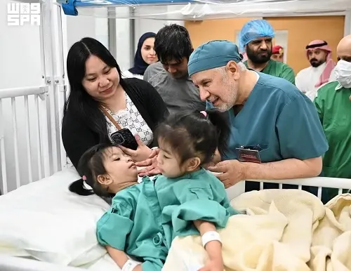 بدء عملية فصل التوأم الفلبيني أوليفيا و جيانا
