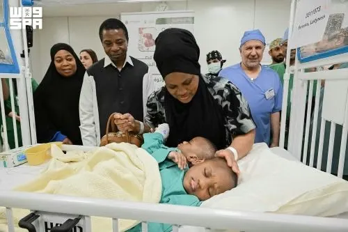 بدء فصل التوأم التنزاني “لايتيينس ولوفنس” في الرياض