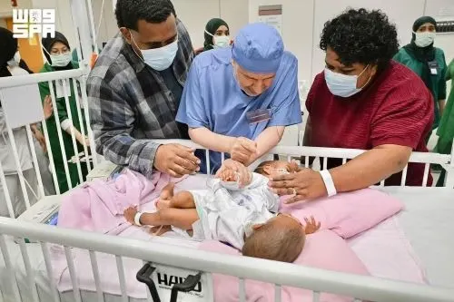 بدء فصل التوأم الفيجي في عملية تستغرق 15 ساعة